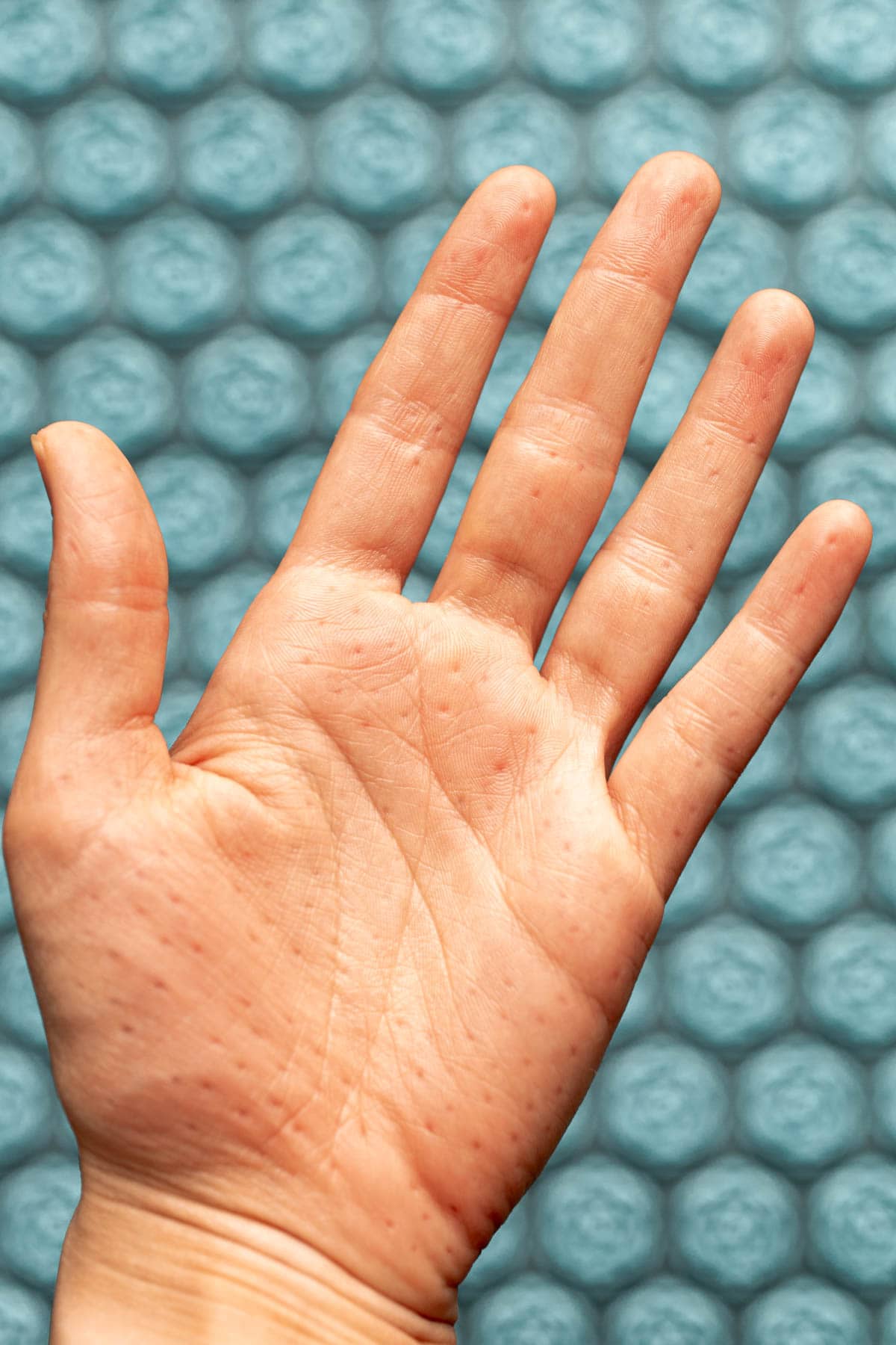 A close-up of a hand after using the Pranamat acupressure mat. 